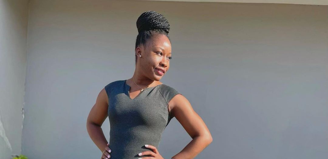 Euridse jeque: “Recebi muito apoio dos familiares ao assumir ter problemas de pele – Acne” Euridse jeque: “Recebi muito apoio dos familiares ao assumir ter problemas de pele – Acne”