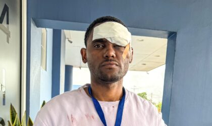 Fotojornalista, activista e Jurista Bruno Gomes é alvejado na manifestação em Maputo