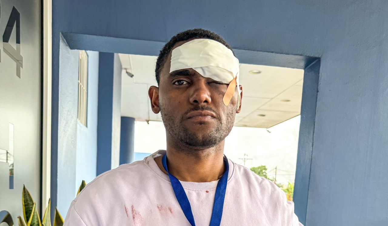 Fotojornalista, activista e Jurista Bruno Gomes é alvejado na manifestação em Maputo