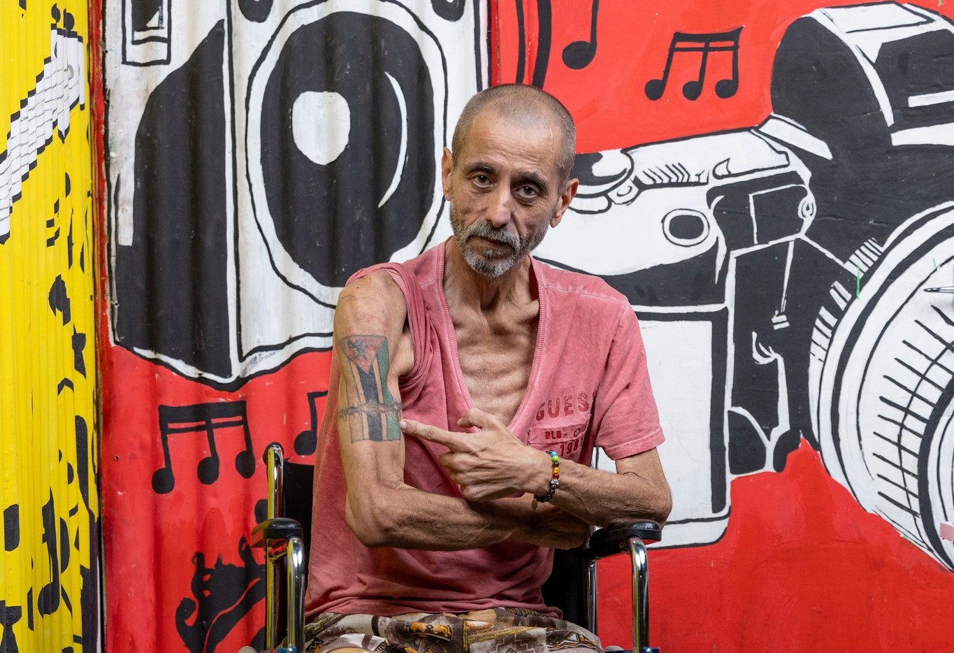 Fotógrafo Zé Bomba em busca de apoio para reabilitação após amputação