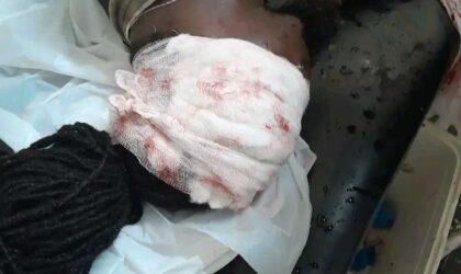 Joel Amaral, conhecido como “MC Trufafá”, baleado em Quelimane