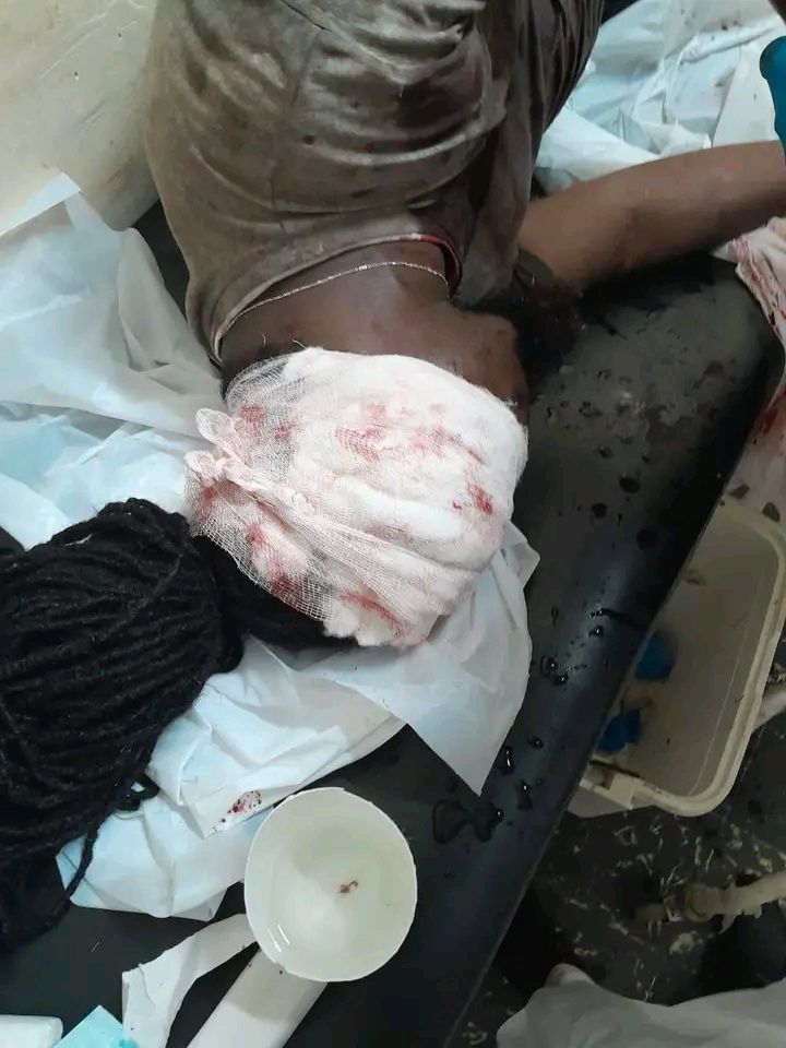 Joel Amaral, conhecido como “MC Trufafá”, baleado em Quelimane Joel Amaral, conhecido como “MC Trufafá”, baleado em Quelimane